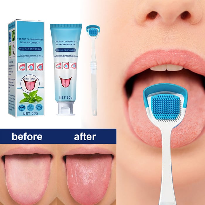 Probiotic Tongue Cleaning Gel