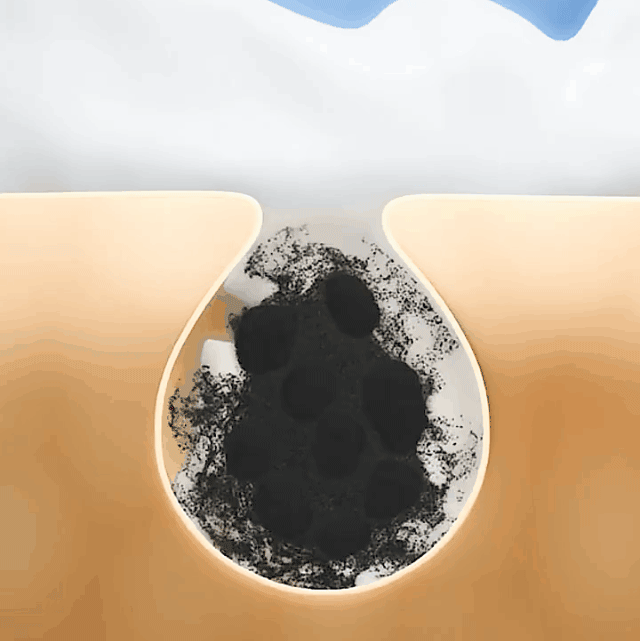 123456_22.gif