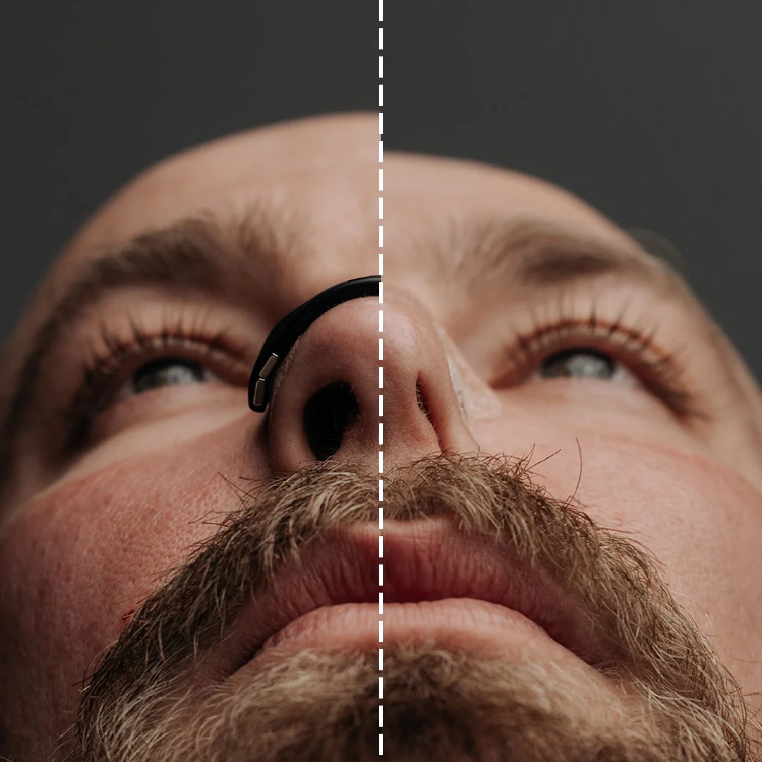 SEAGRIL™ - Nasal Breathing Dilators